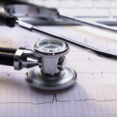 EKG